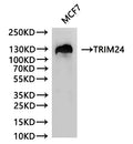 Western Blot
Positive WB detected in: MCF-7 whole cell lysate(30µg)
All lanes: TRIM24 antibody at 1:1000
Secondary
Goat polyclonal to rabbit IgG at 1/40000 dilution
Predicted band size: 117 kDa
Observed band size: 130 kDa
Exposure time：2min
