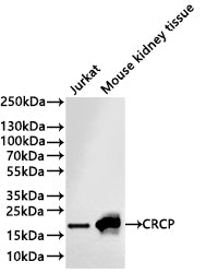 Western Blot
Positive WB detected in: Jurkat whole cell lysate(30µg) , Mouse kidney tissue lysate(30µg) 
All lanes: CRCP polymerase beta antibody at 1:1000
Secondary
Goat polyclonal to rabbit IgG at 1/40000 dilution
Predicted band size: 17 kDa
Observed band size: 22 kDa
Exposure time：3min