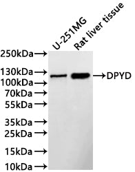 Western Blot
Positive WB detected in: U-251MG whole cell lysate(30µg) , Rat liver tissue lysate(30µg) 
All lanes: DYPD antibody at 1:1000
Secondary
Goat polyclonal to rabbit IgG at 1/40000 dilution
Predicted band size: 111 kDa
Observed band size: 111 kDa
Exposure time：2min