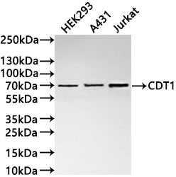 Western Blot
Positive WB detected in: HEK293 whole cell lysate(30µg) , A431 whole cell lysate(30µg) , Jurkat whole cell lysate(30µg) 
All lanes: CDT1 antibody at 1:1000
Secondary
Goat polyclonal to rabbit IgG at 1/40000 dilution
Predicted band size: 60 kDa
Observed band size: 70 kDa
Exposure time：2min
