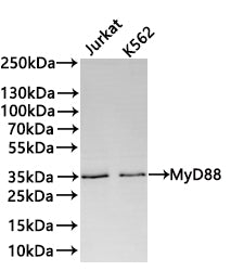 Western Blot
Positive WB detected in: Jurkat whole cell lysate(30µg) , K562 whole cell lysate(30µg) 
All lanes: MyD88 antibody at 1:1000
Secondary
Goat polyclonal to rabbit IgG at 1/40000 dilution
Predicted band size: 33 kDa
Observed band size: 35 kDa
Exposure time：2min