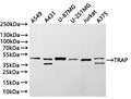 Western Blot
Positive WB detected in: A549 whole cell lysate(30µg) , A431 whole cell lysate(30µg) , U-87MG whole cell lysate(30µg) , U-251MG whole cell lysate(30µg) , Jurkat whole cell lysate(30µg) , A375 whole cell lysate(30µg) 
All lanes: TRAP antibody at 1:1000
Secondary
Goat polyclonal to rabbit IgG at 1/40000 dilution
Predicted band size: 37 kDa
Observed band size: 37, 47 kDa
Exposure time：3min