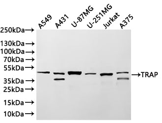 Western Blot
Positive WB detected in: A549 whole cell lysate(30µg) , A431 whole cell lysate(30µg) , U-87MG whole cell lysate(30µg) , U-251MG whole cell lysate(30µg) , Jurkat whole cell lysate(30µg) , A375 whole cell lysate(30µg) 
All lanes: TRAP antibody at 1:1000
Secondary
Goat polyclonal to rabbit IgG at 1/40000 dilution
Predicted band size: 37 kDa
Observed band size: 37, 47 kDa
Exposure time：3min