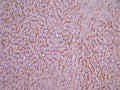 IHC image of CSB-RA139995A0HU diluted at 1:100 and staining in paraffin-embedded human liver tissue performed on a Leica BondTM system. After dewaxing and hydration, antigen retrieval was mediated by high pressure in a citrate buffer (pH 6.0). Section was blocked with 10% normal goat serum 30min at RT. Then primary antibody (1% BSA) was incubated at 4°C overnight. The primary is detected by a Goat anti-rabbit polymer IgG labeled by HRP and visualized using 0.05% DAB.