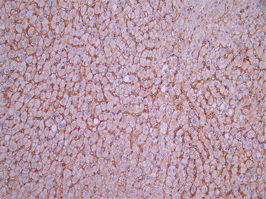 IHC image of CSB-RA139995A0HU diluted at 1:100 and staining in paraffin-embedded human liver tissue performed on a Leica BondTM system. After dewaxing and hydration, antigen retrieval was mediated by high pressure in a citrate buffer (pH 6.0). Section was blocked with 10% normal goat serum 30min at RT. Then primary antibody (1% BSA) was incubated at 4°C overnight. The primary is detected by a Goat anti-rabbit polymer IgG labeled by HRP and visualized using 0.05% DAB.