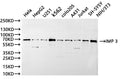 Western Blot
Positive WB detected in: Hela whole cell lysate(30µg), HepG2 whole cell lysate(30µg), U251 whole cell lysate(30µg), K562 whole cell lysate(30µg), colo205 whole cell lysate(30µg), A431 whole cell lysate(30µg), Jurkat whole cell lysate(30µg), SH-SY5Y whole cell lysate(30µg), NIH/3T3 whole cell lysate(30µg)
All lanes: IMP 3 antibody at 1:1000
Secondary
Goat polyclonal to rabbit IgG at 1/40000 dilution
Predicted band size: 64 kDa
Observed band size: 69 kDa
Exposure time：20s