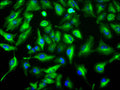 Immunofluorescence staining of U-251MG cell with CSB-RA143207A0HU at 1:50, counter-stained with DAPI. The cells were fixed in 4% formaldehyde, permeabilized using 0.2% Triton X-100 and blocked in 10% normal Goat Serum. The cells were then incubated with the antibody overnight at 4°C. The secondary antibody was Alexa Fluor 488-congugated AffiniPure Goat Anti-Rabbit IgG(H+L) .