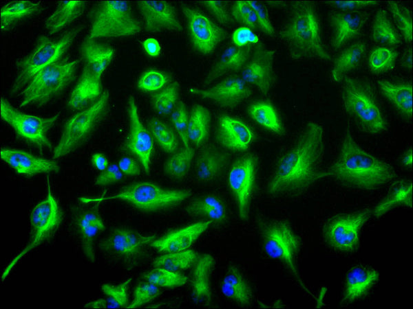 Immunofluorescence staining of U-251MG cell with CSB-RA143207A0HU at 1:50, counter-stained with DAPI. The cells were fixed in 4% formaldehyde, permeabilized using 0.2% Triton X-100 and blocked in 10% normal Goat Serum. The cells were then incubated with the antibody overnight at 4°C. The secondary antibody was Alexa Fluor 488-congugated AffiniPure Goat Anti-Rabbit IgG(H+L) .