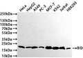 Western Blot
Positive WB detected in: HeLa whole cell lysate(30µg) , HepG2 whole cell lysate(30µg) , A549 whole cell lysate(30µg) , PC-3 whole cell lysate(30µg) , MCF-7 whole cell lysate(30µg) , K562 whole cell lysate(30µg) , Jurkat whole cell lysate(30µg) , HEK293 whole cell lysate(30µg) 
All lanes: BID antibody at 1:1000
Secondary
Goat polyclonal to rabbit IgG at 1/50000 dilution
Predicted band size: 22 kDa
Observed band size: 22 kDa
Exposure time: 3min