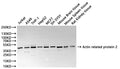 Western Blot, 
Positive WB detected in:Jurkat whole cell lysate(30µg), A549 whole cell lysate(30µg), THP-1 whole cell lysate(30µg), HepG2 whole cell lysate(30µg), MCF7 whole cell lysate(30µg), SH-SY5Y whole cell lysate(30µg), Mouse brain tissue lysate(30µg), Mouse spleen tissue lysate(30µg), Rat kidney lysate(30µg)
All lanes: Actin related protein 2 antibody at 1:1000
Secondary
Goat polyclonal to rabbit IgG at 1/40000 dilution
Predicted band size: 45 kDa
Observed band size: 45 kDa
Exposure time：10s