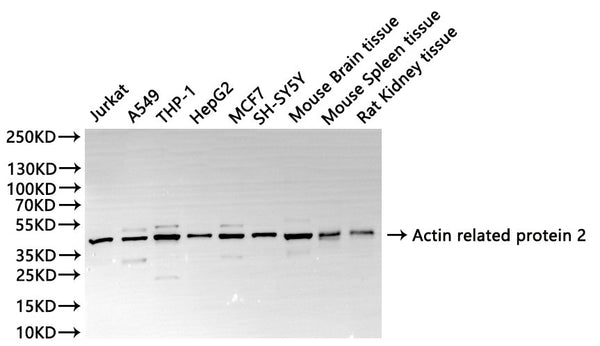 Western Blot, 
Positive WB detected in:Jurkat whole cell lysate(30µg), A549 whole cell lysate(30µg), THP-1 whole cell lysate(30µg), HepG2 whole cell lysate(30µg), MCF7 whole cell lysate(30µg), SH-SY5Y whole cell lysate(30µg), Mouse brain tissue lysate(30µg), Mouse spleen tissue lysate(30µg), Rat kidney lysate(30µg)
All lanes: Actin related protein 2 antibody at 1:1000
Secondary
Goat polyclonal to rabbit IgG at 1/40000 dilution
Predicted band size: 45 kDa
Observed band size: 45 kDa
Exposure time：10s