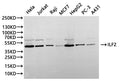 Western Blot
Positive WB detected in: Hela whole cell lysate(30µg), Jurkat whole cell lysate(30µg), Raji whole cell lysate(30µg), MCF-7 whole cell lysate(30µg), HepG2 whole cell lysate(30µg), PC-3 whole cell lysate(30µg), A431 whole cell lysate(30µg)
All lanes: ILF2 antibody at 1:1000
Secondary
Goat polyclonal to rabbit IgG at 1/40000 dilution
Predicted band size: 43 kDa
Observed band size: 43 kDa
Exposure time：20s