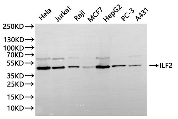 Western Blot
Positive WB detected in: Hela whole cell lysate(30µg), Jurkat whole cell lysate(30µg), Raji whole cell lysate(30µg), MCF-7 whole cell lysate(30µg), HepG2 whole cell lysate(30µg), PC-3 whole cell lysate(30µg), A431 whole cell lysate(30µg)
All lanes: ILF2 antibody at 1:1000
Secondary
Goat polyclonal to rabbit IgG at 1/40000 dilution
Predicted band size: 43 kDa
Observed band size: 43 kDa
Exposure time：20s
