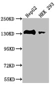Western Blot
Positive WB detected in: HepG2 whole cell lysate, HEK293 whole cell lysate
All lanes: MYLK antibody at 1:2000
Secondary
Goat polyclonal to rabbit IgG at 1/50000 dilution
Predicted band size: 211, 204, 206, 198, 203, 111, 17, 81 kDa
Observed band size: 130-250 kDa