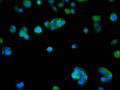 Immunofluorescence staining of HepG2 cell with CSB-RA145644A0HU at 1:50 , counter-stained with DAPI. The cells were fixed in 4% formaldehyde, permeabilized using 0.2% Triton X-100 and blocked in 10% normal Goat Serum. The cells were then incubated with the antibody overnight at 4°C. The secondary antibody was Alexa Fluor 488-congugated AffiniPure Goat Anti-Rabbit IgG(H+L).