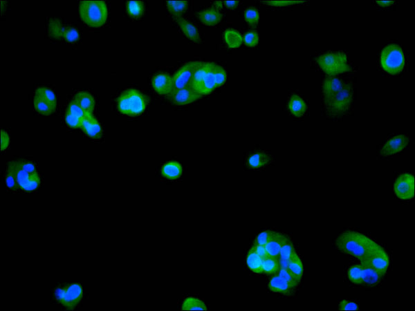 Immunofluorescence staining of HepG2 cell with CSB-RA145644A0HU at 1:50 , counter-stained with DAPI. The cells were fixed in 4% formaldehyde, permeabilized using 0.2% Triton X-100 and blocked in 10% normal Goat Serum. The cells were then incubated with the antibody overnight at 4°C. The secondary antibody was Alexa Fluor 488-congugated AffiniPure Goat Anti-Rabbit IgG(H+L).