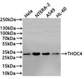Western Blot
Positive WB detected in: HEK293 whole cell lysate(20µg) , Hela whole cell lysate(20µg) ,NTERA-2 whole cell lysate(20µg) , A549 whole cell lysate(20µg) , HL-60 whole cell lysate(20µg) 
All lanes: THOC4 antibody at 1:1000
Secondary
Goat polyclonal to rabbit IgG at 1/40000 dilution
Predicted band size: 27 kDa
Observed band size: 30 kDa
Exposure time：1min