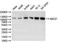 Western Blot
Positive WB detected in: hela whole cell lysate(30µg), A549 whole cell lysate(30µg), Jurkat whole cell lysate(30µg), A431 whole cell lysate(30µg), PC-3 whole cell lysate(30µg), SH-SY5Y whole cell lysate(30µg)
All lanes:ABCG1 antibody at 1:1000
Secondary
Goat polyclonal to rabbit IgG at 1/40000 dilution
Predicted band size: 76 kDa
Observed band size: 110 kDa
Exposure time：2min