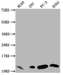 Western Blot
Positive WB detected in: HL60 whole cell lysate, 293 whole cell lysate, PC-3 whole cell lysate, K562 whole cell lysate
All lanes: MIF antibody at 1:1500
Secondary
Goat polyclonal to rabbit IgG at 1/50000 dilution
Predicted band size: 13 kDa
Observed band size: 13 kDa