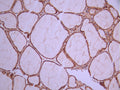 IHC image of CSB-RA147408A0HU diluted at 1:100 and staining in paraffin-embedded human thyroid tissue performed on a Leica BondTM system. After dewaxing and hydration, antigen retrieval was mediated by high pressure in a citrate buffer (pH 6.0). Section was blocked with 10% normal goat serum 30min at RT. Then primary antibody (1% BSA) was incubated at 4°C overnight. The primary is detected by a Goat anti-rabbit polymer IgG labeled by HRP and visualized using 0.05% DAB.