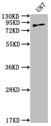 Western Blot
Positive WB detected in: U87 whole cell lysate
All lanes: TGM2 antibody at 1:2000
Secondary
Goat polyclonal to rabbit IgG at 1/50000 dilution
Predicted band size: 78, 62, 39 kDa
Observed band size: 78 kDa
