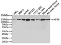 Western Blot, 
Positive WB detected in:Hela whole cell lysate(30µg), MCF-7 whole cell lysate(30µg), Jurkat whole cell lysate(30µg), HEK293 whole cell lysate(30µg), COLO-205 whole cell lysate(30µg), SH-SY5Y whole cell lysate(30µg), Mouse brain tissue lysate(30µg), Rat brain tissue lysate(30µg)
All lanes: ERK5 antibody at 1:1000
Secondary
Goat polyclonal to rabbit IgG at 1/40000 dilution
Predicted band size: 88 kDa
Observed band size: 115 kDa
Exposure time：2min