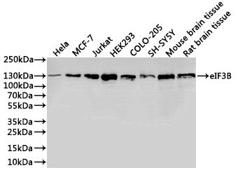 Western Blot, 
Positive WB detected in:Hela whole cell lysate(30µg), MCF-7 whole cell lysate(30µg), Jurkat whole cell lysate(30µg), HEK293 whole cell lysate(30µg), COLO-205 whole cell lysate(30µg), SH-SY5Y whole cell lysate(30µg), Mouse brain tissue lysate(30µg), Rat brain tissue lysate(30µg)
All lanes: ERK5 antibody at 1:1000
Secondary
Goat polyclonal to rabbit IgG at 1/40000 dilution
Predicted band size: 88 kDa
Observed band size: 115 kDa
Exposure time：2min