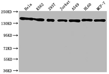 Western Blot
Positive WB detected in: Hela whole cell lysate, K562 whole cell lysate, 293T whole cell lysate, Jurkat whole cell lysate, A549 whole cell lysate, HL60 whole cell lysate, MCF-7 whole cell lysate
All lanes: SMC1A antibody at 1:1500
Secondary
Goat polyclonal to rabbit IgG at 1/50000 dilution
Predicted band size: 144 kDa
Observed band size: 144 kDa