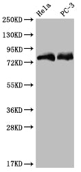 Western Blot
Positive WB detected in: Hela whole cell lysate, PC3 whole cell lysate
All lanes: SENP1 antibody at 1:2000
Secondary
Goat polyclonal to rabbit IgG at 1/50000 dilution
Predicted band size: 74 kDa
Observed band size: 72-95 kDa