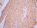 IHC image of CSB-RA150297A0HU diluted at 1:100 and staining in paraffin-embedded human placenta tissue performed on a Leica BondTM system. After dewaxing and hydration, antigen retrieval was mediated by high pressure in a citrate buffer (pH 6.0). Section was blocked with 10% normal goat serum 30min at RT. Then primary antibody (1% BSA) was incubated at 4°C overnight. The primary is detected by a Goat anti-rabbit polymer IgG labeled by HRP and visualized using 0.05% DAB.