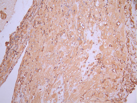 IHC image of CSB-RA150297A0HU diluted at 1:100 and staining in paraffin-embedded human placenta tissue performed on a Leica BondTM system. After dewaxing and hydration, antigen retrieval was mediated by high pressure in a citrate buffer (pH 6.0). Section was blocked with 10% normal goat serum 30min at RT. Then primary antibody (1% BSA) was incubated at 4°C overnight. The primary is detected by a Goat anti-rabbit polymer IgG labeled by HRP and visualized using 0.05% DAB.