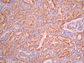 IHC image of CSB-RA151335A0HU diluted at 1:100 and staining in paraffin-embedded human kidney tissue performed on a Leica BondTM system. After dewaxing and hydration, antigen retrieval was mediated by high pressure in a citrate buffer (pH 6.0). Section was blocked with 10% normal goat serum 30min at RT. Then primary antibody (1% BSA) was incubated at 4°C overnight. The primary is detected by a Goat anti-rabbit polymer IgG labeled by HRP and visualized using 0.05% DAB.