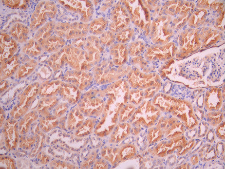 IHC image of CSB-RA151335A0HU diluted at 1:100 and staining in paraffin-embedded human kidney tissue performed on a Leica BondTM system. After dewaxing and hydration, antigen retrieval was mediated by high pressure in a citrate buffer (pH 6.0). Section was blocked with 10% normal goat serum 30min at RT. Then primary antibody (1% BSA) was incubated at 4°C overnight. The primary is detected by a Goat anti-rabbit polymer IgG labeled by HRP and visualized using 0.05% DAB.