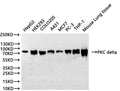 Western Blot
Positive WB detected in: HepG2 whole cell lysate(30µg), HEK293 whole cell lysate(30µg), COLO205 whole cell lysate(30µg), A431 whole cell lysate(30µg), MCF7 whole cell lysate(30µg), PC-3 whole cell lysate(30µg), THP-1 whole cell lysate(30µg), Mouse lung tissue lysate(30µg)
All lanes: PKC delta antibody at 1:1000
Secondary
Goat polyclonal to rabbit IgG at 1/40000 dilution
Predicted band size: 78 kDa
Observed band size: 80 kDa
Exposure time：10S