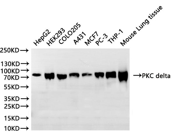 Western Blot
Positive WB detected in: HepG2 whole cell lysate(30µg), HEK293 whole cell lysate(30µg), COLO205 whole cell lysate(30µg), A431 whole cell lysate(30µg), MCF7 whole cell lysate(30µg), PC-3 whole cell lysate(30µg), THP-1 whole cell lysate(30µg), Mouse lung tissue lysate(30µg)
All lanes: PKC delta antibody at 1:1000
Secondary
Goat polyclonal to rabbit IgG at 1/40000 dilution
Predicted band size: 78 kDa
Observed band size: 80 kDa
Exposure time：10S