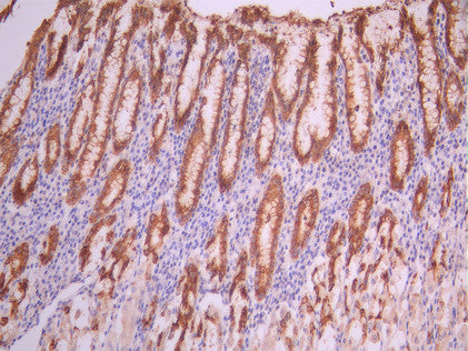 IHC image of CSB-RA152151A0HU diluted at 1:100 and staining in paraffin-embedded human stomach tissue performed on a Leica BondTM system. After dewaxing and hydration, antigen retrieval was mediated by high pressure in a citrate buffer (pH 6.0). Section was blocked with 10% normal goat serum 30min at RT. Then primary antibody (1% BSA) was incubated at 4°C overnight. The primary is detected by a Goat anti-rabbit polymer IgG labeled by HRP and visualized using 0.05% DAB.
