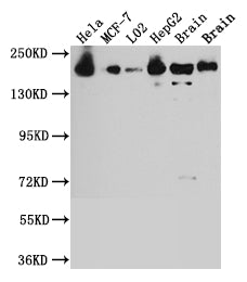 ROCK2 Antibody – Figure 1 of 2