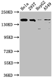 Western Blot
Positive WB detected in: Hela whole cell lysate, 293T whole cell lysate, HepG2 whole cell lysate, A549 whole cell lysate
All lanes: BRD4 antibody at 1:1500
Secondary
Goat polyclonal to rabbit IgG at 1/50000 dilution
Predicted band size: 153, 81, 89 kDa
Observed band size: 153 kDa