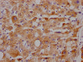 IHC image of CSB-RA153677A0HU diluted at 1:100 and staining in paraffin-embedded human liver tissue performed on a Leica BondTM system. After dewaxing and hydration, antigen retrieval was mediated by high pressure in a citrate buffer (pH 6.0) . Section was blocked with 10% normal goat serum 30min at RT. Then primary antibody (1% BSA) was incubated at 4℃ overnight. The primary is detected by a Goat anti-rabbit IgG polymer labeled by HRP and visualized using 0.05% DAB.
