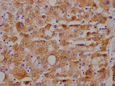 IHC image of CSB-RA153677A0HU diluted at 1:100 and staining in paraffin-embedded human liver tissue performed on a Leica BondTM system. After dewaxing and hydration, antigen retrieval was mediated by high pressure in a citrate buffer (pH 6.0) . Section was blocked with 10% normal goat serum 30min at RT. Then primary antibody (1% BSA) was incubated at 4℃ overnight. The primary is detected by a Goat anti-rabbit IgG polymer labeled by HRP and visualized using 0.05% DAB.