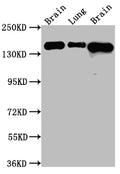 Western Blot
Positive WB detected in: Rat Brain whole cell lysate, Rat Lung whole cell lysate, Mouse Brain whole cell lysate
All lanes: FGFR2 Antibody at 1:1000
Secondary
Goat polyclonal to rabbit IgG at 1/50000 dilution
Predicted band size: 93, 87, 93, 77, 92, 89, 86, 29, 80, 93, 97, 92, 41, 80, 80, 77, 80 kDa
Observed band size: 145 kDa