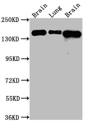 Western Blot
Positive WB detected in: Rat Brain whole cell lysate, Rat Lung whole cell lysate, Mouse Brain whole cell lysate
All lanes: FGFR2 Antibody at 1:1000
Secondary
Goat polyclonal to rabbit IgG at 1/50000 dilution
Predicted band size: 93, 87, 93, 77, 92, 89, 86, 29, 80, 93, 97, 92, 41, 80, 80, 77, 80 kDa
Observed band size: 145 kDa