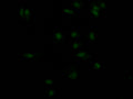 Immunofluorescence staining of MCF7 Cells with CSB-RA155156A0HU at 1:50, counter-stained with DAPI. The cells were fixed in 4% formaldehyde, permeated by 0.2% TritonX-100, and blocked in 10% normal Goat Serum. The cells were then incubated with the antibody overnight at 4℃. Nuclear DNA was labeled in blue with DAPI. The secondary antibody was FITC-conjugated AffiniPure Goat Anti-Rabbit IgG (H+L) .