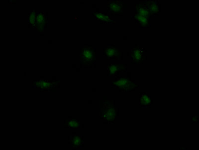 Immunofluorescence staining of MCF7 Cells with CSB-RA155156A0HU at 1:50, counter-stained with DAPI. The cells were fixed in 4% formaldehyde, permeated by 0.2% TritonX-100, and blocked in 10% normal Goat Serum. The cells were then incubated with the antibody overnight at 4℃. Nuclear DNA was labeled in blue with DAPI. The secondary antibody was FITC-conjugated AffiniPure Goat Anti-Rabbit IgG (H+L) .
