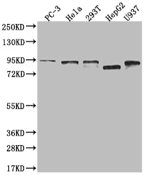 Western Blot
Positive WB detected in: PC3 whole cell lysate, Hela whole cell lysate, 293T whole cell lysate, HepG2 whole cell lysate, U937 whole cell lysate
All lanes: DBF4 antibody at 1:2000
Secondary
Goat polyclonal to rabbit IgG at 1/50000 dilution
Predicted band size: 77, 27 kDa
Observed band size: 72-95 kDa
