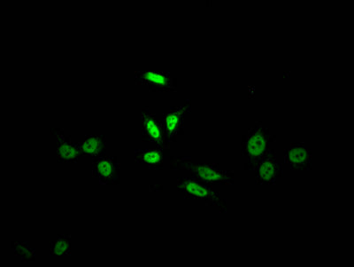 Immunofluorescence staining of HepG2 Cells with CSB-RA155372A0HU at 1:50, counter-stained with DAPI. The cells were fixed in 4% formaldehyde, permeated by 0.2% TritonX-100, and blocked in 10% normal Goat Serum. The cells were then incubated with the antibody overnight at 4℃. Nuclear DNA was labeled in blue with DAPI. The secondary antibody was FITC-conjugated AffiniPure Goat Anti-Rabbit IgG (H+L) .