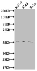 Western Blot
Positive WB detected in: MCF-7 whole cell lysate, A549 whole cell lysate, Hela whole cell lysate
All lanes: FADS1 antibody at 1:2000
Secondary
Goat polyclonal to rabbit IgG at 1/50000 dilution
Predicted band size: 52, 43 kDa
Observed band size: 55 kDa