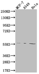 Western Blot
Positive WB detected in: MCF-7 whole cell lysate, A549 whole cell lysate, Hela whole cell lysate
All lanes: FADS1 antibody at 1:2000
Secondary
Goat polyclonal to rabbit IgG at 1/50000 dilution
Predicted band size: 52, 43 kDa
Observed band size: 55 kDa