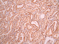 IHC image of CSB-RA155738A0HU diluted at 1:100 and staining in paraffin-embedded human kidney tissue performed on a Leica BondTM system. After dewaxing and hydration, antigen retrieval was mediated by high pressure in a citrate buffer (pH 6.0). Section was blocked with 10% normal goat serum 30min at RT. Then primary antibody (1% BSA) was incubated at 4°C overnight. The primary is detected by a Goat anti-rabbit polymer IgG labeled by HRP and visualized using 0.05% DAB.