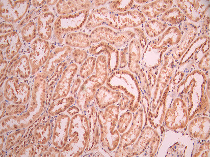 IHC image of CSB-RA155738A0HU diluted at 1:100 and staining in paraffin-embedded human kidney tissue performed on a Leica BondTM system. After dewaxing and hydration, antigen retrieval was mediated by high pressure in a citrate buffer (pH 6.0). Section was blocked with 10% normal goat serum 30min at RT. Then primary antibody (1% BSA) was incubated at 4°C overnight. The primary is detected by a Goat anti-rabbit polymer IgG labeled by HRP and visualized using 0.05% DAB.
